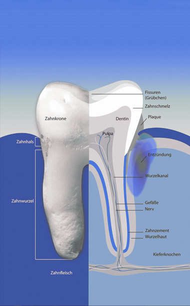 Paradontologie / Behandlung von Zahnfleischerkrankungen